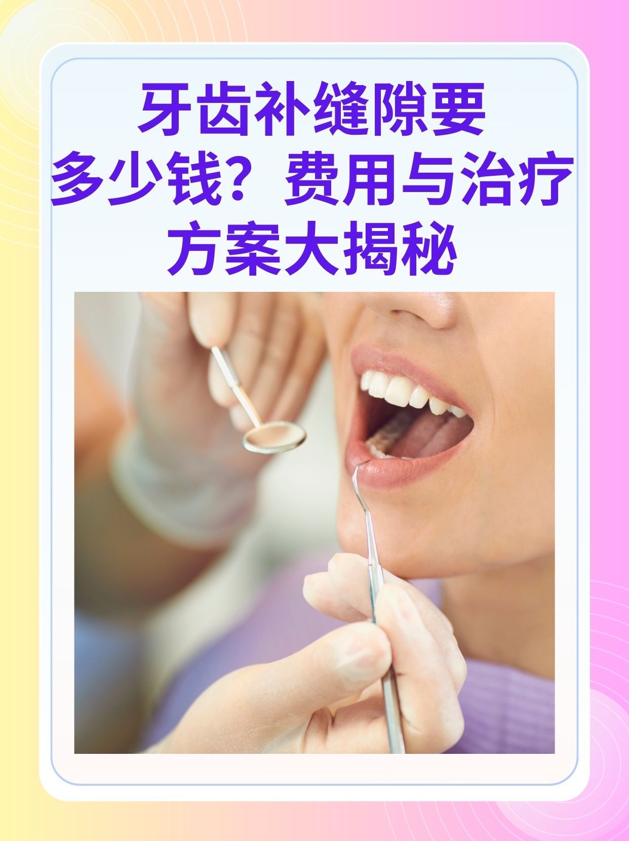 汕头补牙医保可以报销吗(补牙医保可以报销吗 哪些可以报销呢)